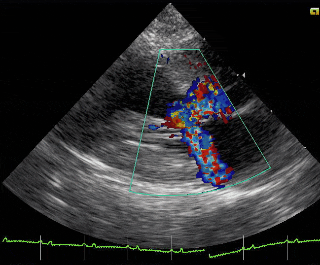 Echocardiography_of_hypertrophic-obstructive_cardiomyopathy_in_a_domestic_cat  
